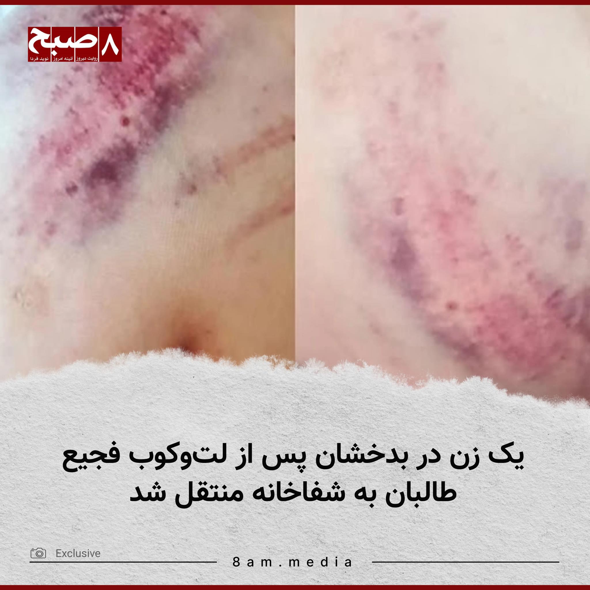 Taliban Brutally Assault Woman in Badakhshan